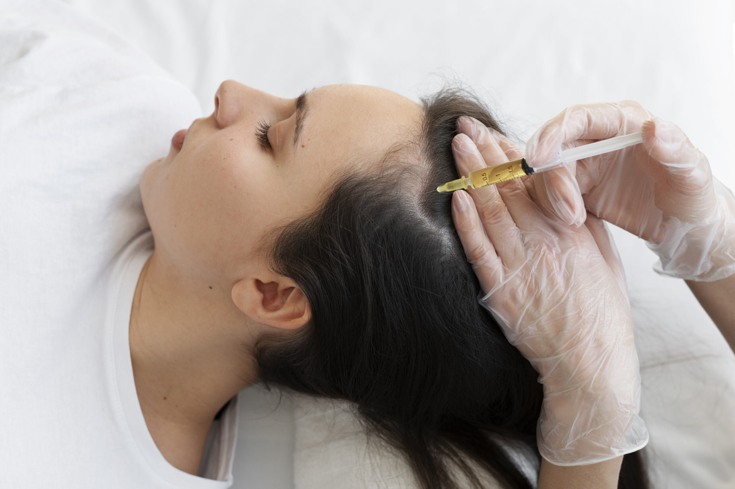 Woman getting scalp prp treatment high angle